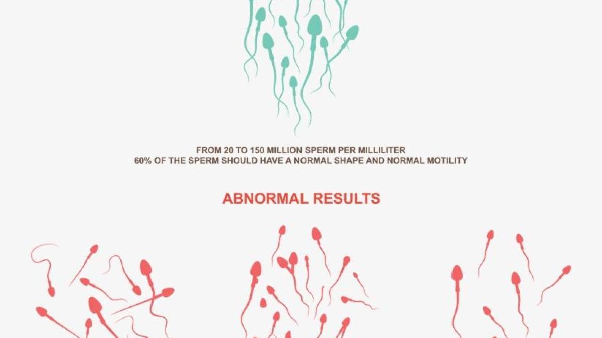 TYPES OF TERATOSPERMIA: mild, moderate, and severe