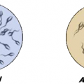 AZOOSPERMIE NATURAL TREATMENT: Dawasanté experts