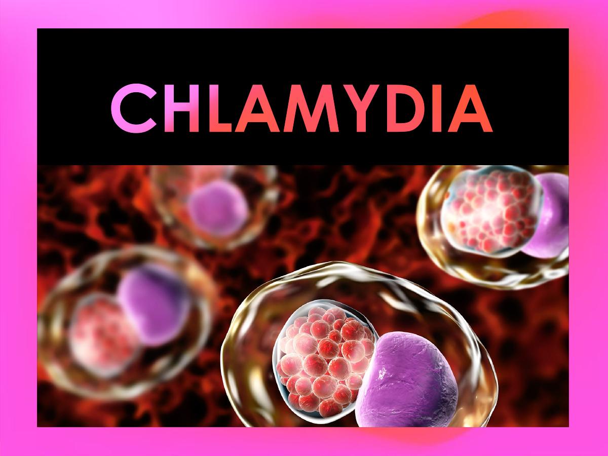 Chlamydia 