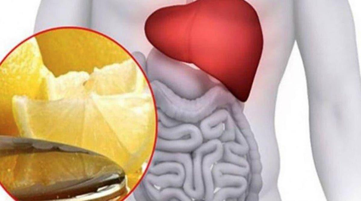 le citron et l'hépatite b