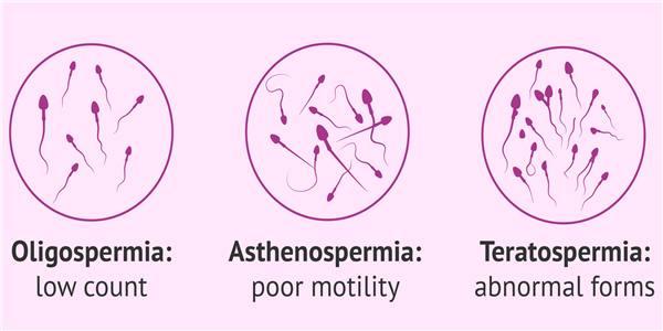 MALE INFERTILITY TERATOSPERMIA