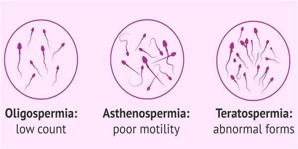 MALE INFERTILITY TERATOSPERMIA