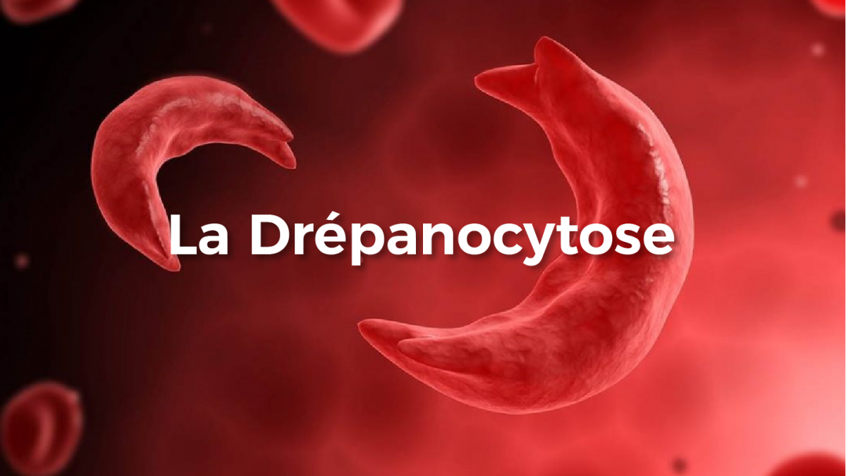 Plantes pour guérir naturellement de l'anémie falciforme (Drépanocytose)