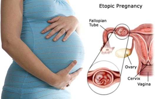 Epotic prengency15be13a7e4dd6e9 44833587