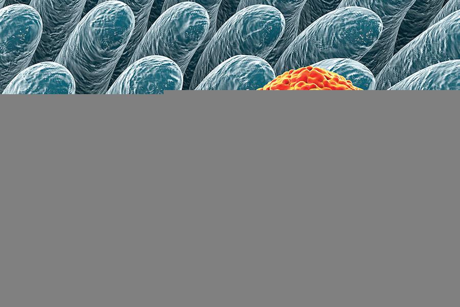 Natural treatments for hepatitis B symptoms