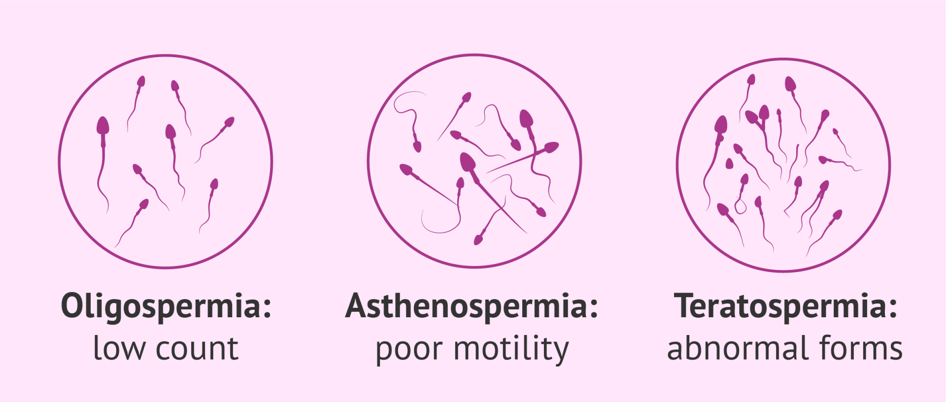 OLIGO-ASTHENO-TERATOSPERMY