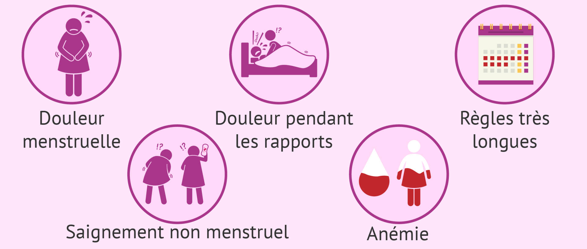 ADENOMYOSE SYMPTÔMES : Traitement naturel