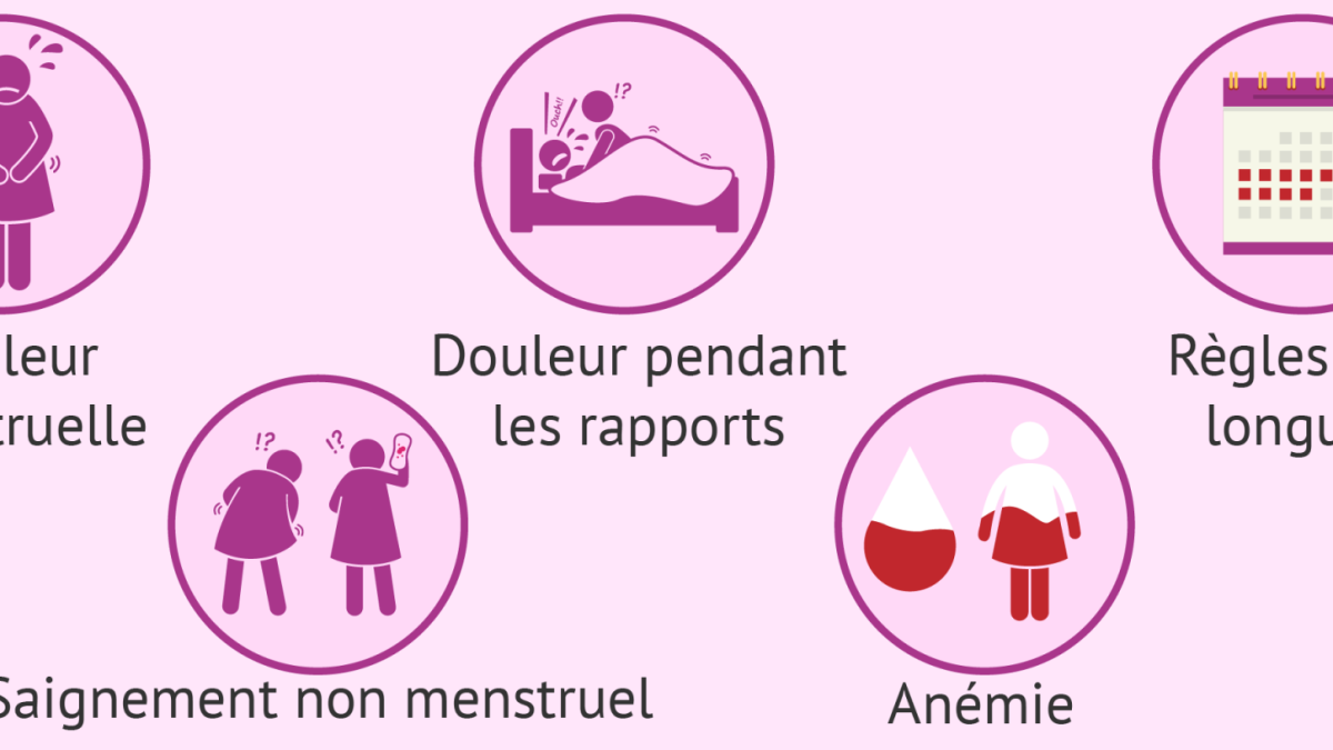 ADENOMYOSE SYMPTÔMES : Traitement naturel
