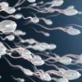 Teratospermie