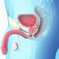 Tisane plante pour soigner la prostate