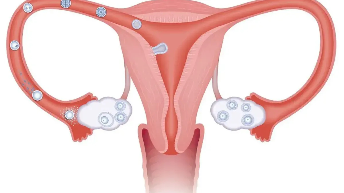 medicina natural para trompas obstruidas
