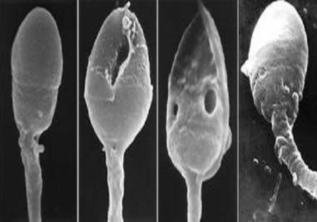 THE CAUSES OF TERATOSPERMIA: Natural treatment
